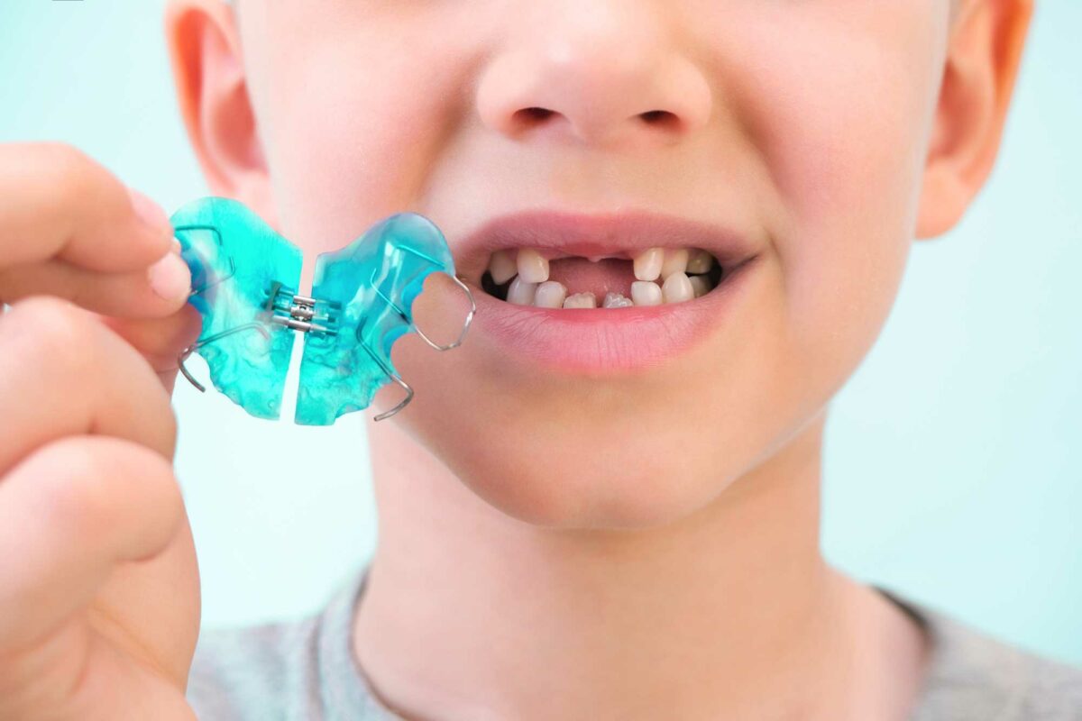 Disyuntor dental: tratamiento en niños